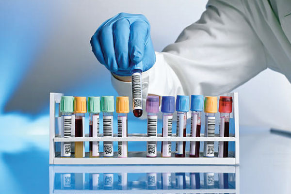 Massive Health Data Breach Hits 1.6 Million at US Lab Testing Company